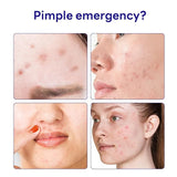 Mediheal 痘贴44入 DermaClear SpotPatch